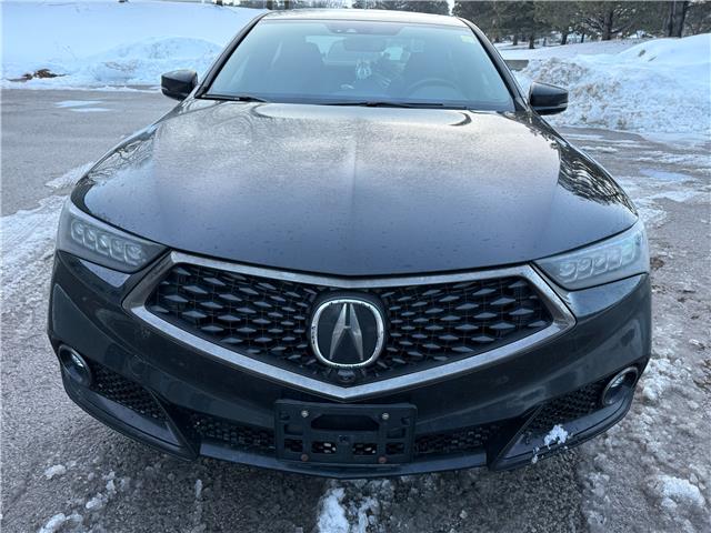 2020 Acura TLX Elite A-Spec (Stk: 45559A) in Newmarket - Image 8 of 32