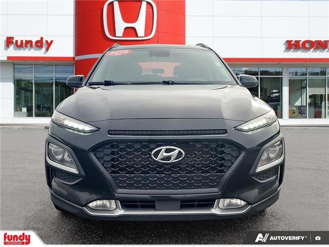 2018 Hyundai Kona 2.0L Luxury (Stk: N205229A) in Saint John - Image 8 of 28