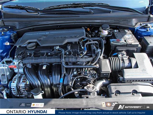2026 Hyundai Elantra Luxury w/Two-Tone Interior (Stk: 7-1601) in Whitby - Image 6 of 25