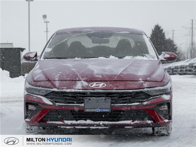 2025 Hyundai Elantra Preferred w/Tech Package (Stk: 864248) in Milton - Image 2 of 23