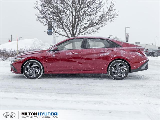 2025 Hyundai Elantra Preferred w/Tech Package (Stk: 864248) in Milton - Image 3 of 23