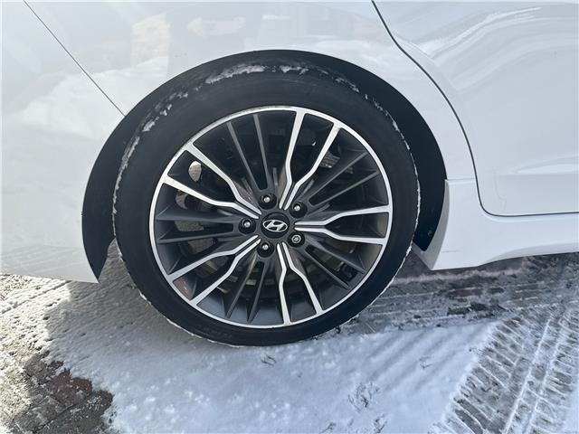 2018 Hyundai Elantra Sport Tech (Stk: 5T98A) in Blenheim - Image 4 of 12