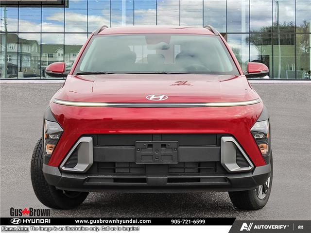 2026 Hyundai Kona 2.0L Preferred w/Trend Package (Stk: U417691) in Brooklin - Image 2 of 25