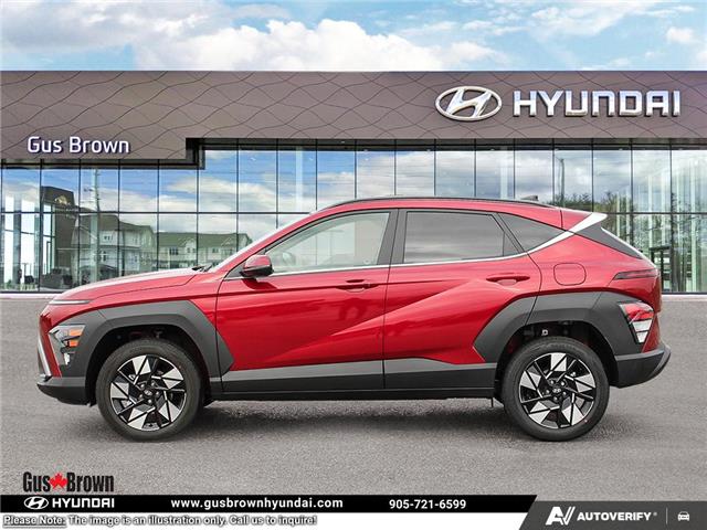 2026 Hyundai Kona 2.0L Preferred w/Trend Package (Stk: U417691) in Brooklin - Image 3 of 25