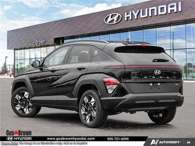 2026 Hyundai Kona 2.0L Preferred (Stk: U431550) in Brooklin - Image 4 of 26