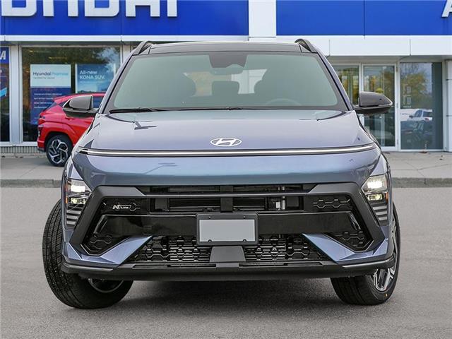 2026 Hyundai Kona 1.6T N Line Ultimate (Stk: 261984) in Aurora - Image 2 of 23