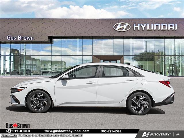2026 Hyundai Elantra Preferred w/Tech Package (Stk: U150091) in Brooklin - Image 3 of 26