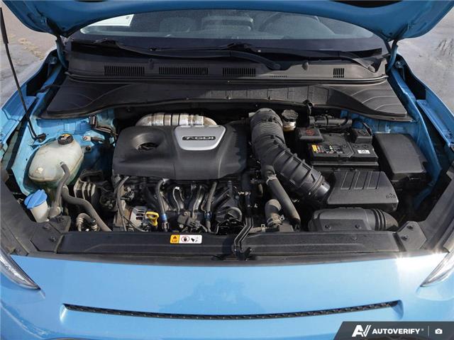 2020 Hyundai Kona 1.6T Trend (Stk: 174055) in London - Image 8 of 27