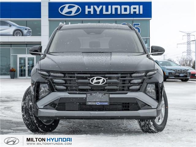 2026 Hyundai Tucson Preferred (Stk: 037643) in Milton - Image 2 of 23