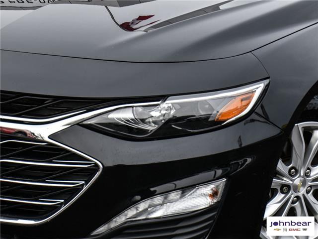 2019 Chevrolet Malibu LT (Stk: U4363) in Hamilton - Image 3 of 31