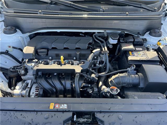 2025 Hyundai Venue Ultimate w/Black Interior (IVT) (Stk: 16U101622) in Markham - Image 26 of 26 2025 Hyundai Venue Ultimate w/Black Interior (IVT) (Stk: 16U101622) in Markham - Image 26 of 26