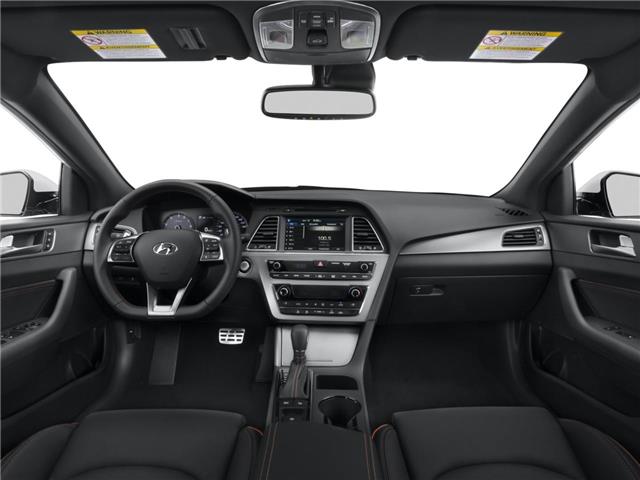2015 Hyundai Sonata GLS (Stk: R69278) in Calgary - Image 5 of 12