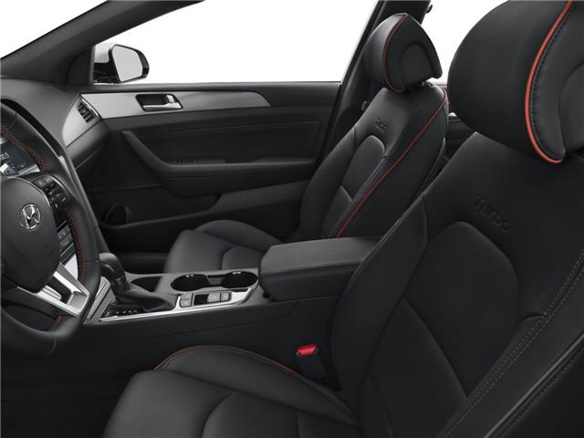 2015 Hyundai Sonata GLS (Stk: R69278) in Calgary - Image 6 of 12