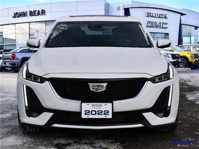 2022 Cadillac CT5 Sport (Stk: LB1851) in St. Catharines - Image 5 of 31 2022 Cadillac CT5 Sport (Stk: LB1851) in St. Catharines - Image 5 of 31