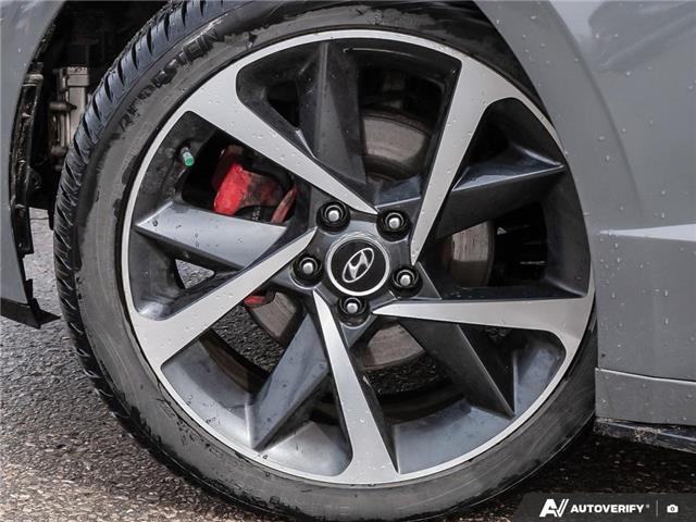 2021 Hyundai Sonata Sport (Stk: 132207) in London - Image 6 of 27