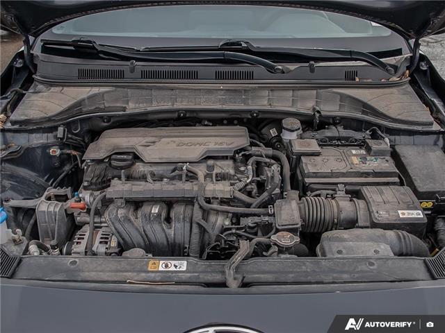 2022 Hyundai Kona 2.0L Essential (Stk: 106523) in London - Image 8 of 27