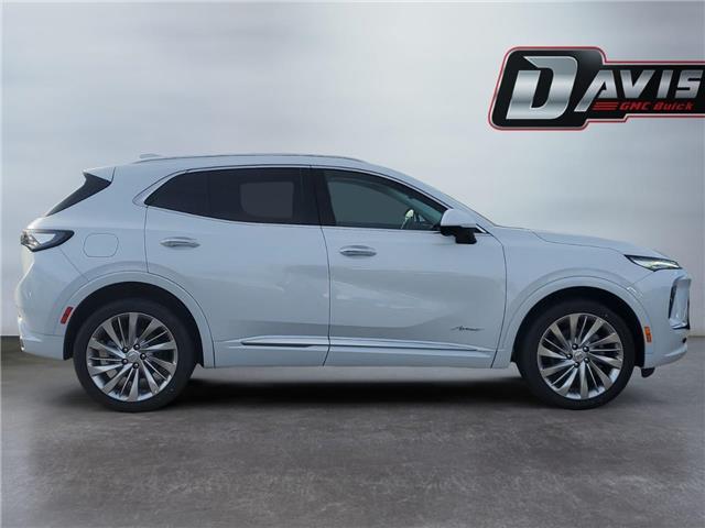 2026 Buick Envision Avenir (Stk: 351759) in Medicine Hat - Image 6 of 15