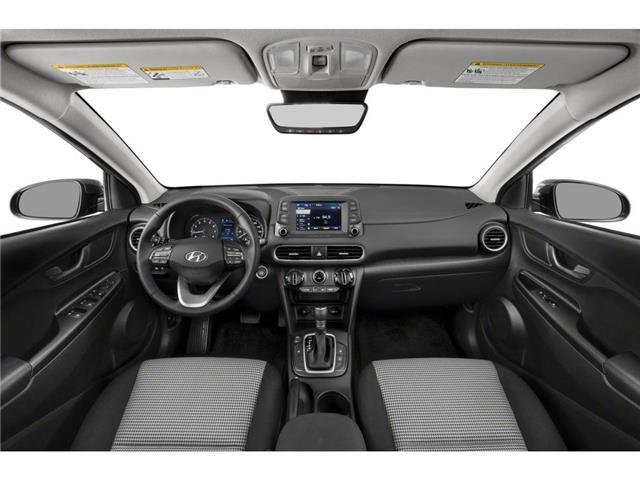 2020 Hyundai Kona 2.0L Preferred (Stk: 26-055A2) in Smiths Falls - Image 3 of 9