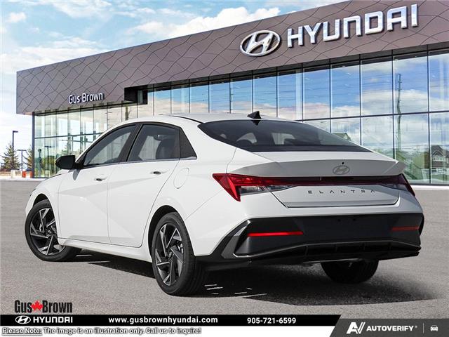 2026 Hyundai Elantra Luxury (Stk: U161838) in Brooklin - Image 4 of 25