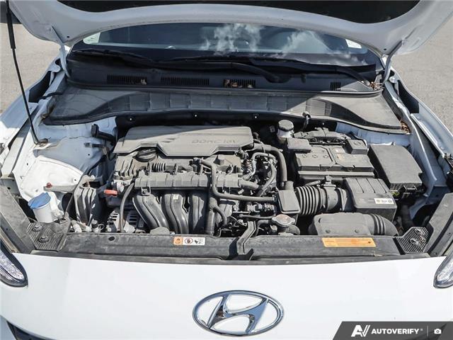 2022 Hyundai Kona 2.0L Essential (Stk: 106401) in London - Image 8 of 24 2022 Hyundai Kona 2.0L Essential (Stk: 106401) in London - Image 8 of 24