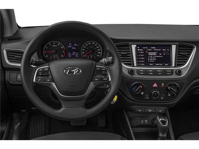 2020 Hyundai Accent  (Stk: DZ1468A) in Ottawa - Image 2 of 9
