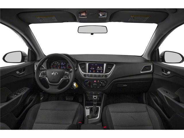 2020 Hyundai Accent  (Stk: DZ1468A) in Ottawa - Image 3 of 9