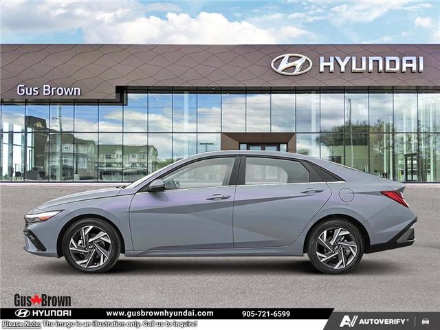 2026 Hyundai Elantra Preferred (Stk: U159186) in Brooklin - Image 3 of 23