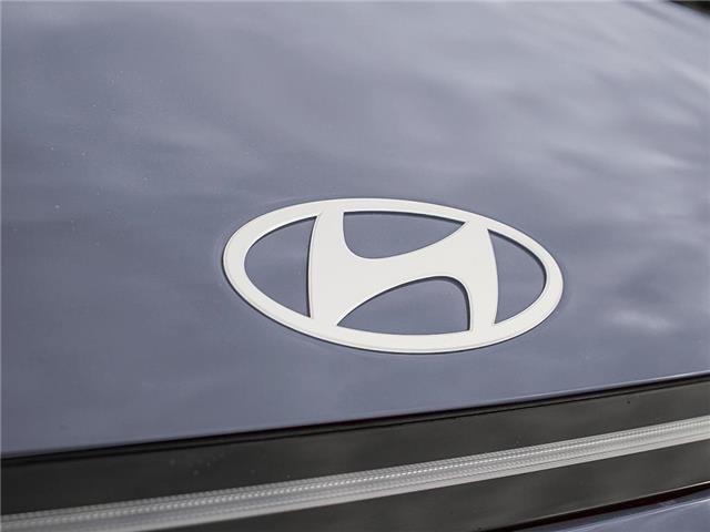 2026 Hyundai Kona 2.0L Preferred w/Trend Package (Stk: 2610243) in Aurora - Image 8 of 22
