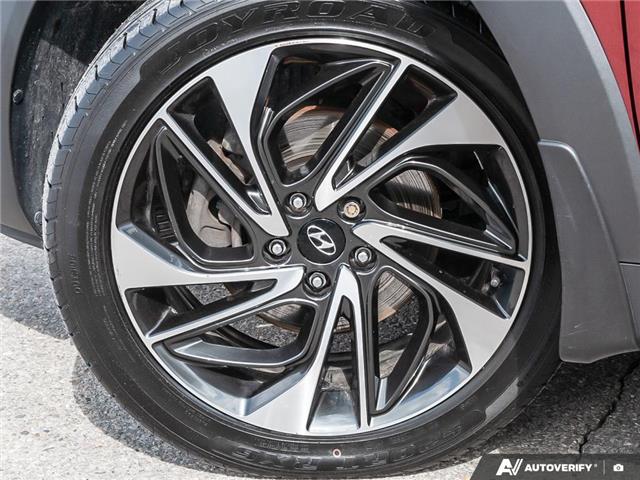 2020 Hyundai Tucson Ultimate (Stk: 174550) in London - Image 6 of 27