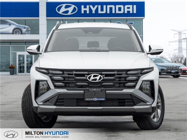 2026 Hyundai Tucson Preferred (Stk: 038720) in Milton - Image 2 of 22