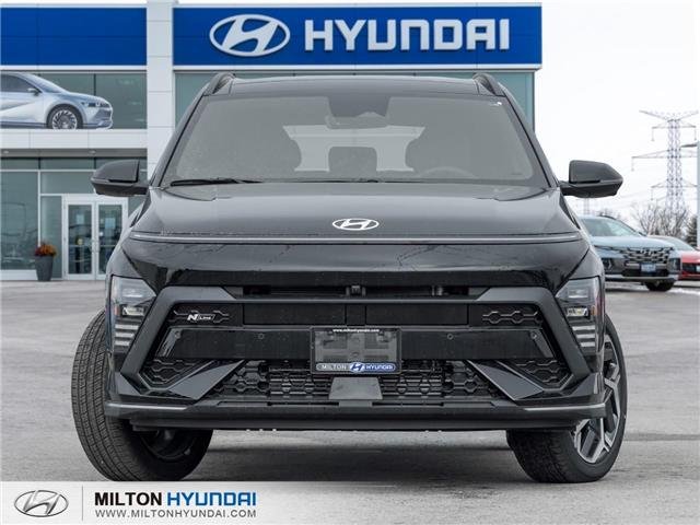 2026 Hyundai Kona 1.6T N Line Ultimate (Stk: 410513) in Milton - Image 2 of 31