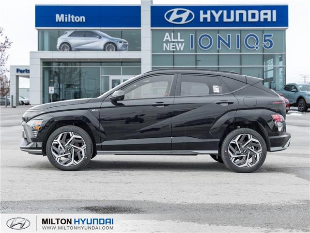 2026 Hyundai Kona 1.6T N Line Ultimate (Stk: 410513) in Milton - Image 3 of 31