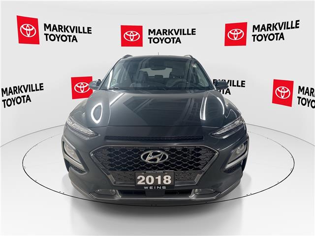 2018 Hyundai Kona 1.6T Ultimate (Stk: 11U4423) in Markham - Image 3 of 34