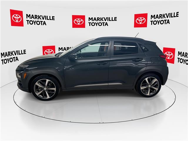 2018 Hyundai Kona 1.6T Ultimate (Stk: 11U4423) in Markham - Image 6 of 34