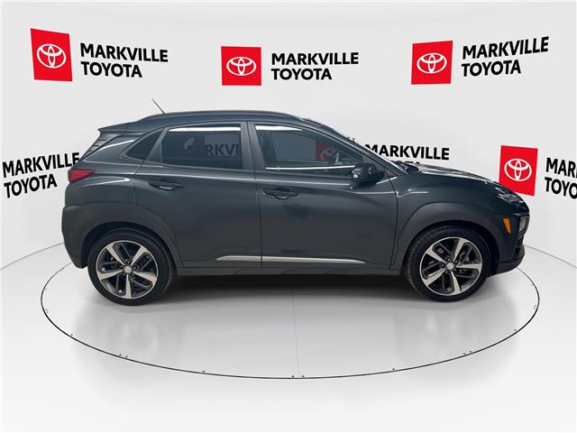 2018 Hyundai Kona 1.6T Ultimate (Stk: 11U4423) in Markham - Image 12 of 34