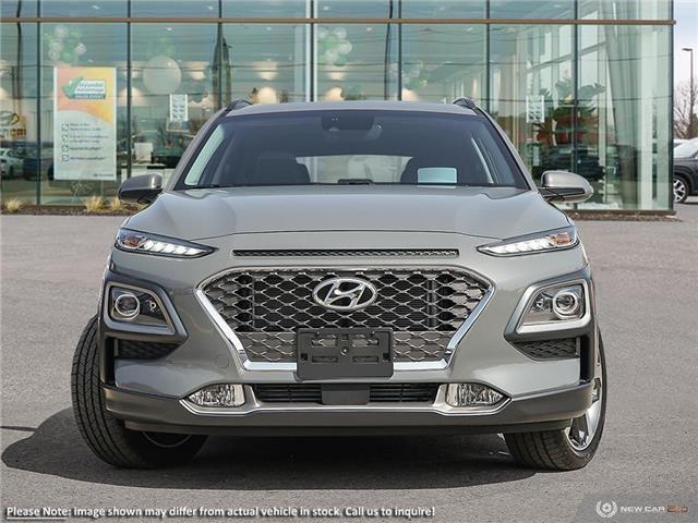 2021 Hyundai Kona 1.6T Ultimate (Stk: 98290) in London - Image 2 of 22