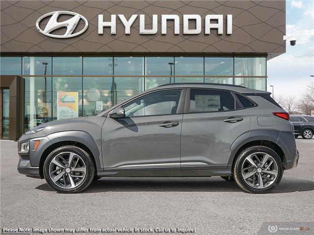 2021 Hyundai Kona 1.6T Ultimate (Stk: 98290) in London - Image 3 of 22