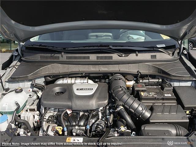 2021 Hyundai Kona 1.6T Ultimate (Stk: 98290) in London - Image 6 of 22