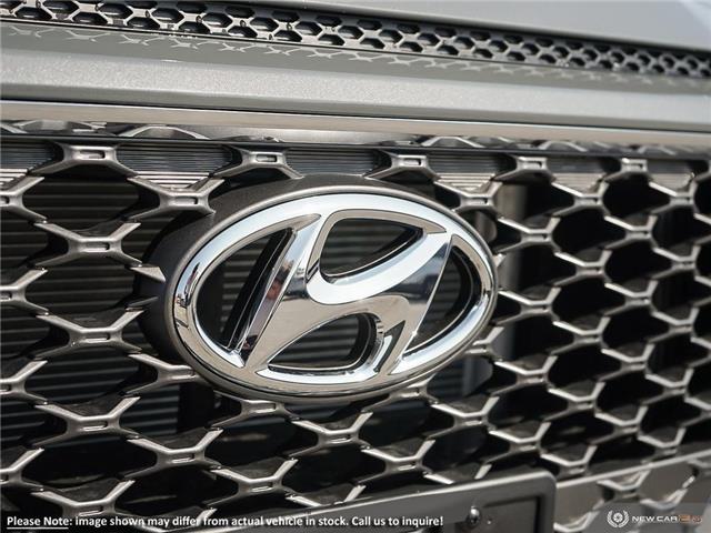 2021 Hyundai Kona 1.6T Ultimate (Stk: 98290) in London - Image 9 of 22