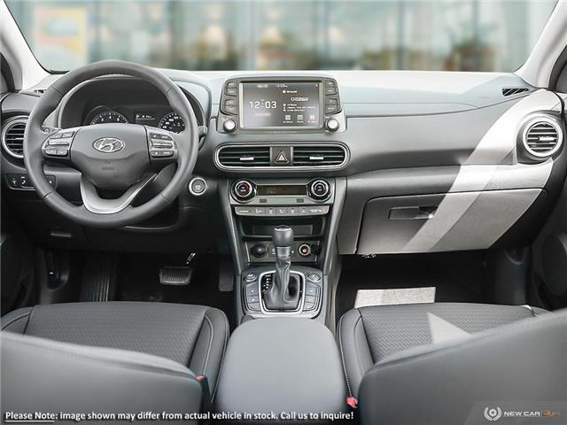 2021 Hyundai Kona 1.6T Ultimate (Stk: 98290) in London - Image 21 of 22