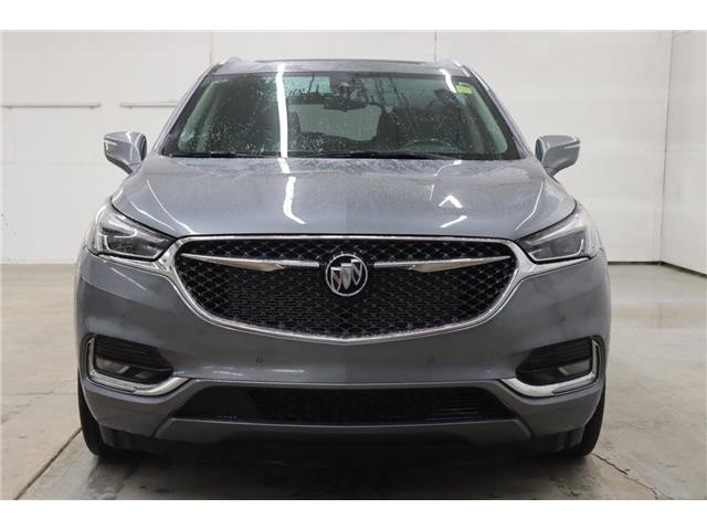 2021 Buick Enclave Avenir (Stk: T3029A) in Watrous - Image 4 of 50