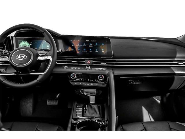2024 Hyundai Elantra HEV Luxury w/Two-Tone Interior (Stk: N26176A) in Timmins - Image 3 of 3