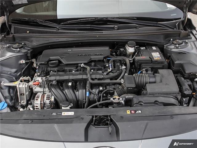 2022 Hyundai Elantra Ultimate w/Two-Tone Interior (Stk: 121294) in London - Image 8 of 19