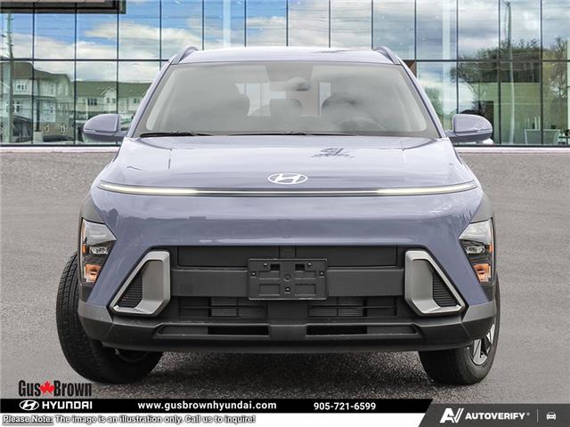 2026 Hyundai Kona 2.0L Preferred w/Trend Package (Stk: U449236) in Brooklin - Image 2 of 24