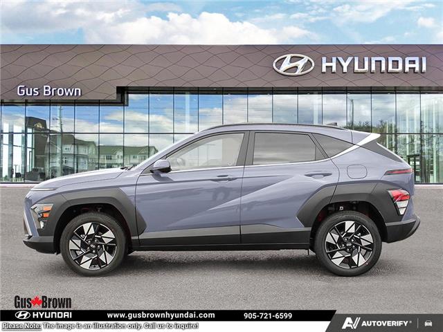 2026 Hyundai Kona 2.0L Preferred w/Trend Package (Stk: U449236) in Brooklin - Image 3 of 24