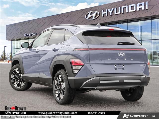 2026 Hyundai Kona 2.0L Preferred w/Trend Package (Stk: U449236) in Brooklin - Image 4 of 24
