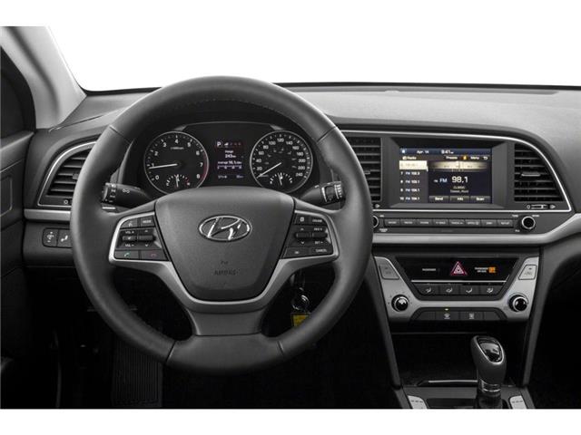 2017 Hyundai Elantra GLS (Stk: T150A) in Chatham - Image 4 of 11