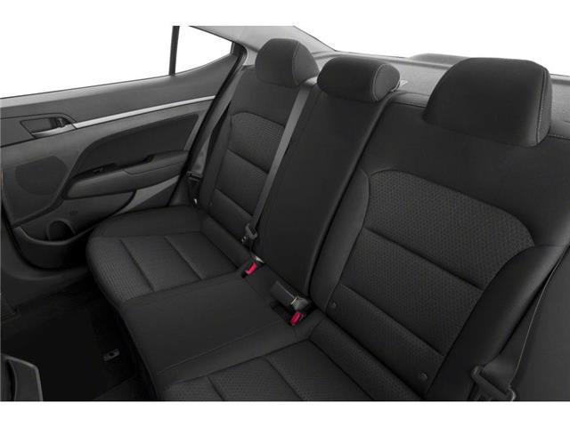 2017 Hyundai Elantra GLS (Stk: T150A) in Chatham - Image 9 of 11