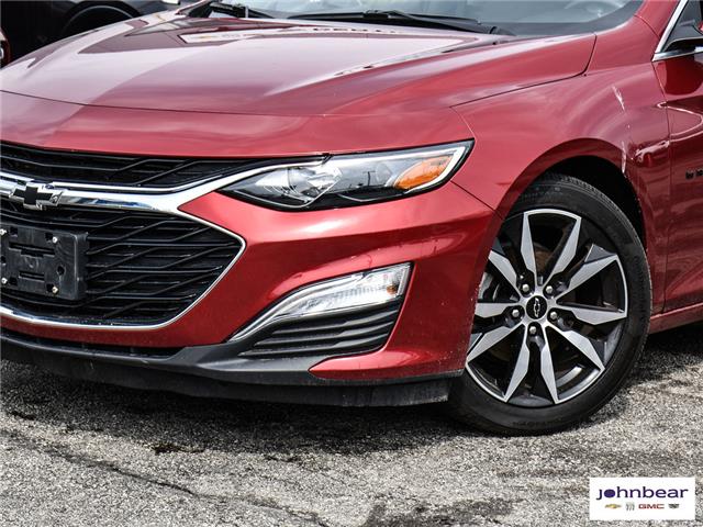2021 Chevrolet Malibu RS (Stk: U4411) in Hamilton - Image 2 of 26