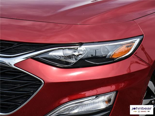 2021 Chevrolet Malibu RS (Stk: U4411) in Hamilton - Image 3 of 26